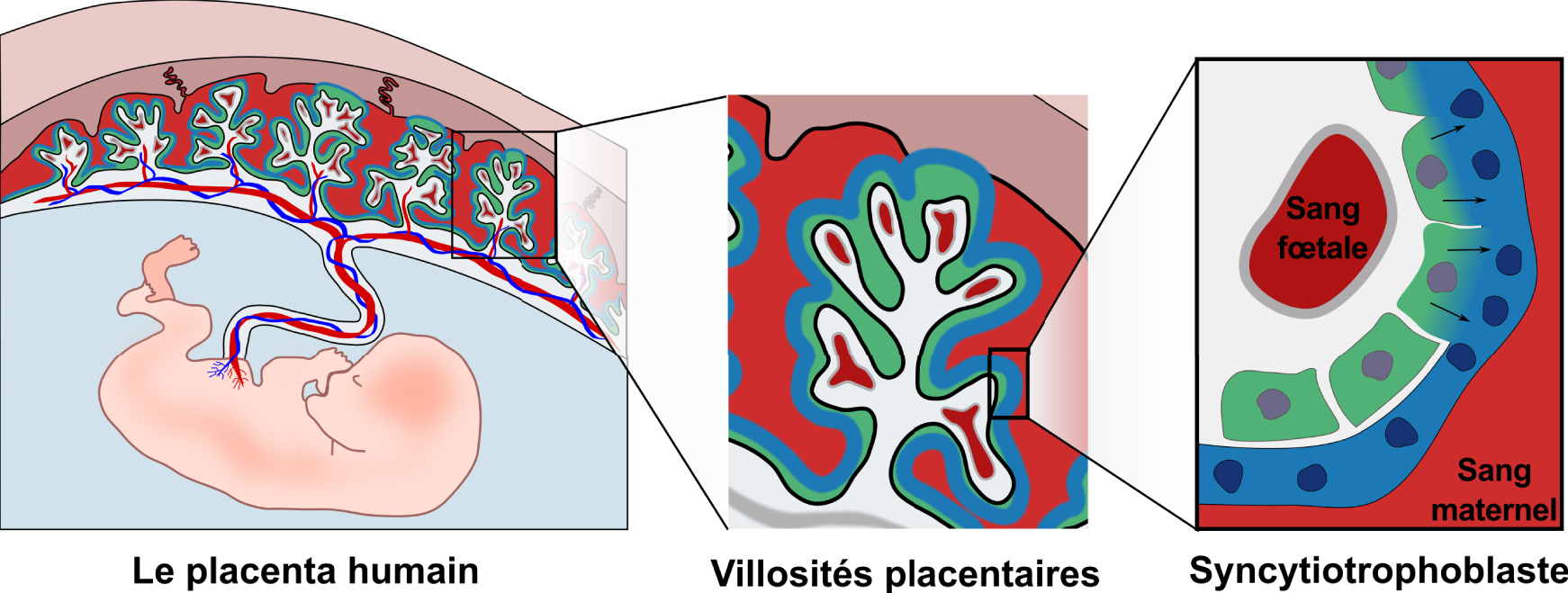 Pregnancy complications and Interferon-induced transmembrane proteins